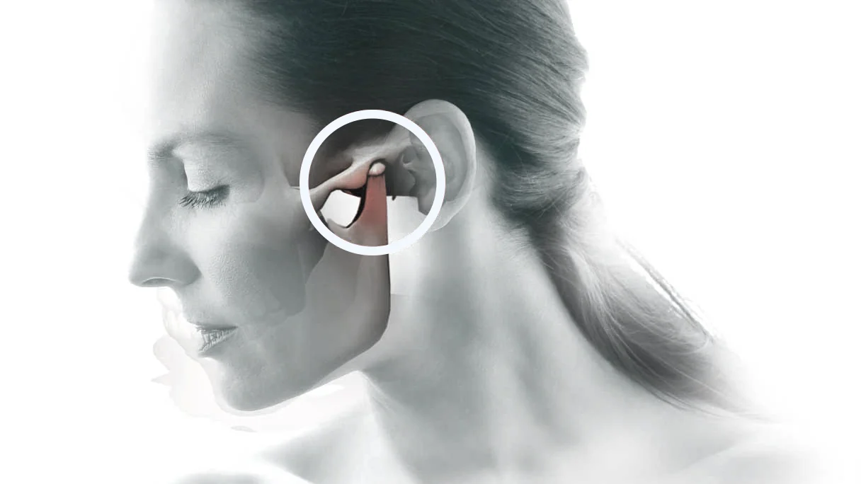 Ilustração da articulação temporomandibular, a ATM